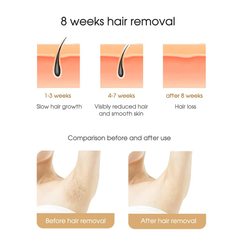 IPL Laser Epilator Body Bikini Laser Hair Removal For Women Flash Depilator Pulse Permanent Laser Epilator Home Use Epilator Aimak Store