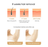 IPL Laser Epilator Body Bikini Laser Hair Removal For Women Flash Depilator Pulse Permanent Laser Epilator Home Use Epilator Aimak Store